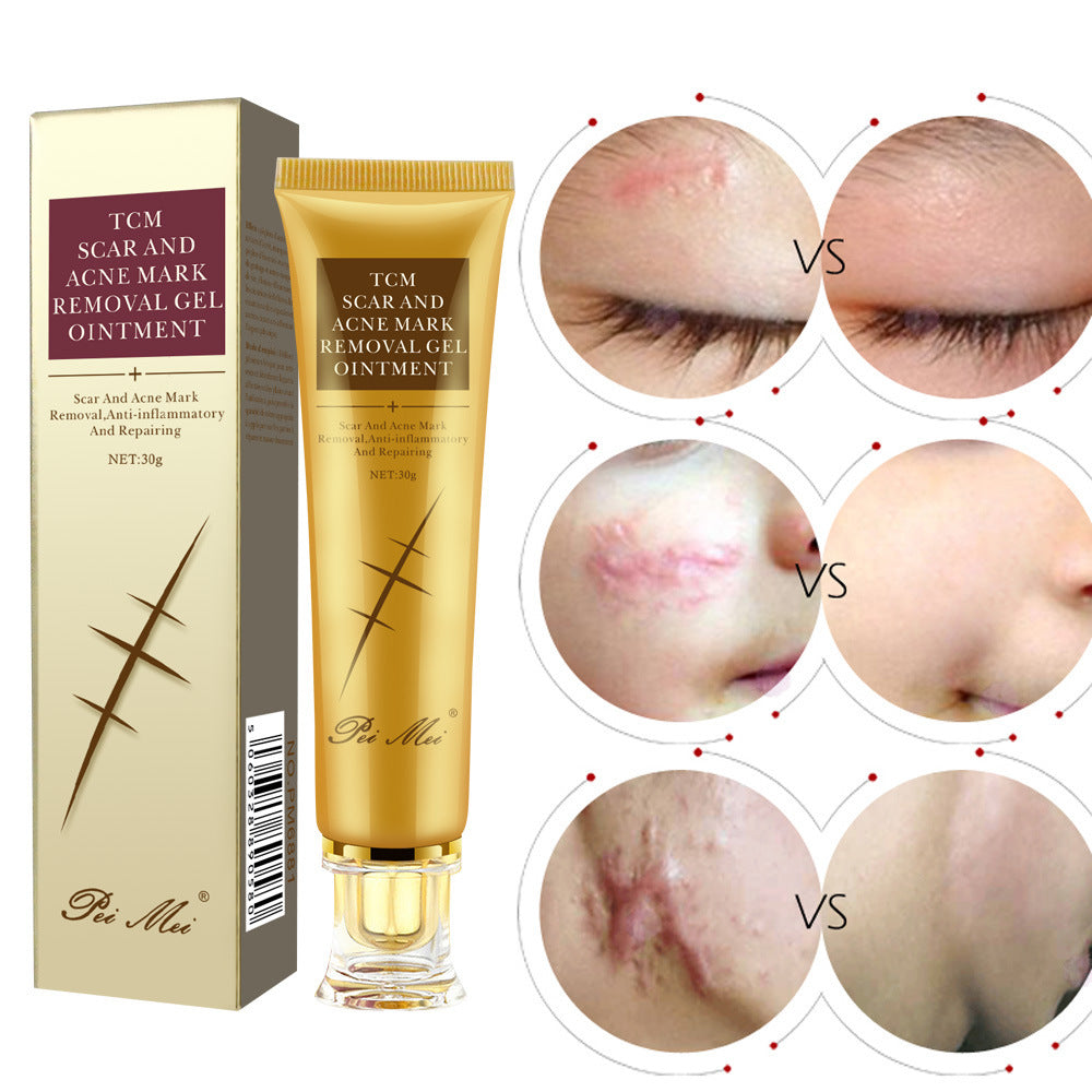 Light Scar Cream Scar Fine Grain Desalination Skin Care Products chicpolly