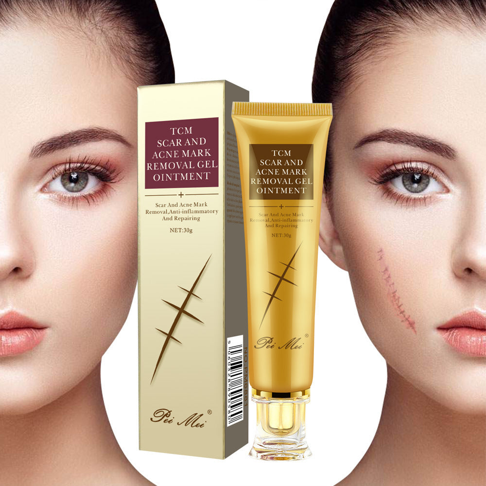 Light Scar Cream Scar Fine Grain Desalination Skin Care Products chicpolly