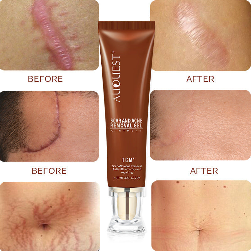 Moisturizing And Repairing Scar Skin Care Cream chicpolly