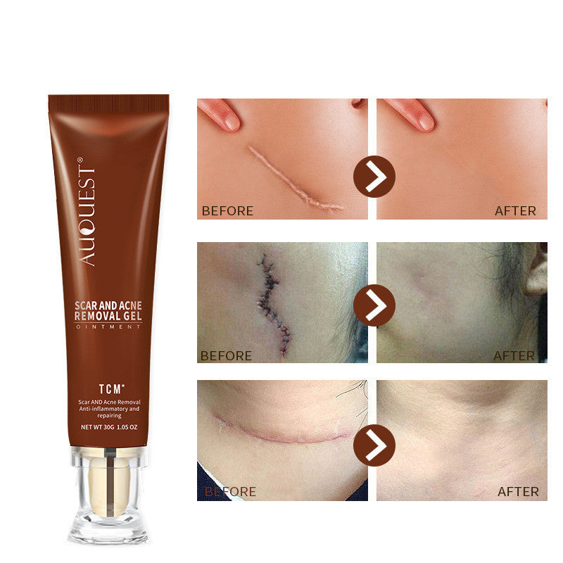 Moisturizing And Repairing Scar Skin Care Cream chicpolly