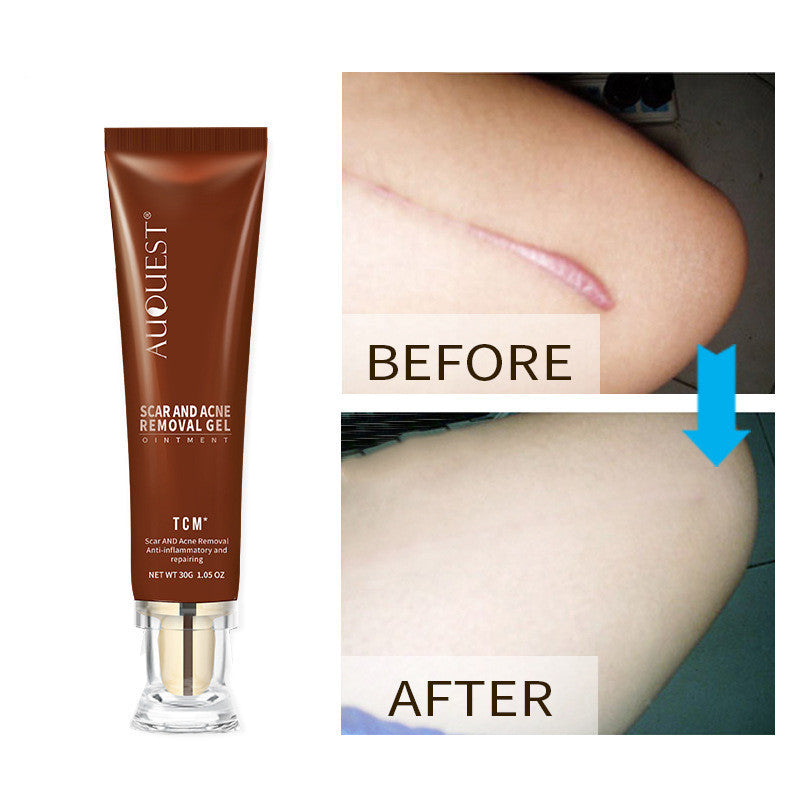 Moisturizing And Repairing Scar Skin Care Cream chicpolly