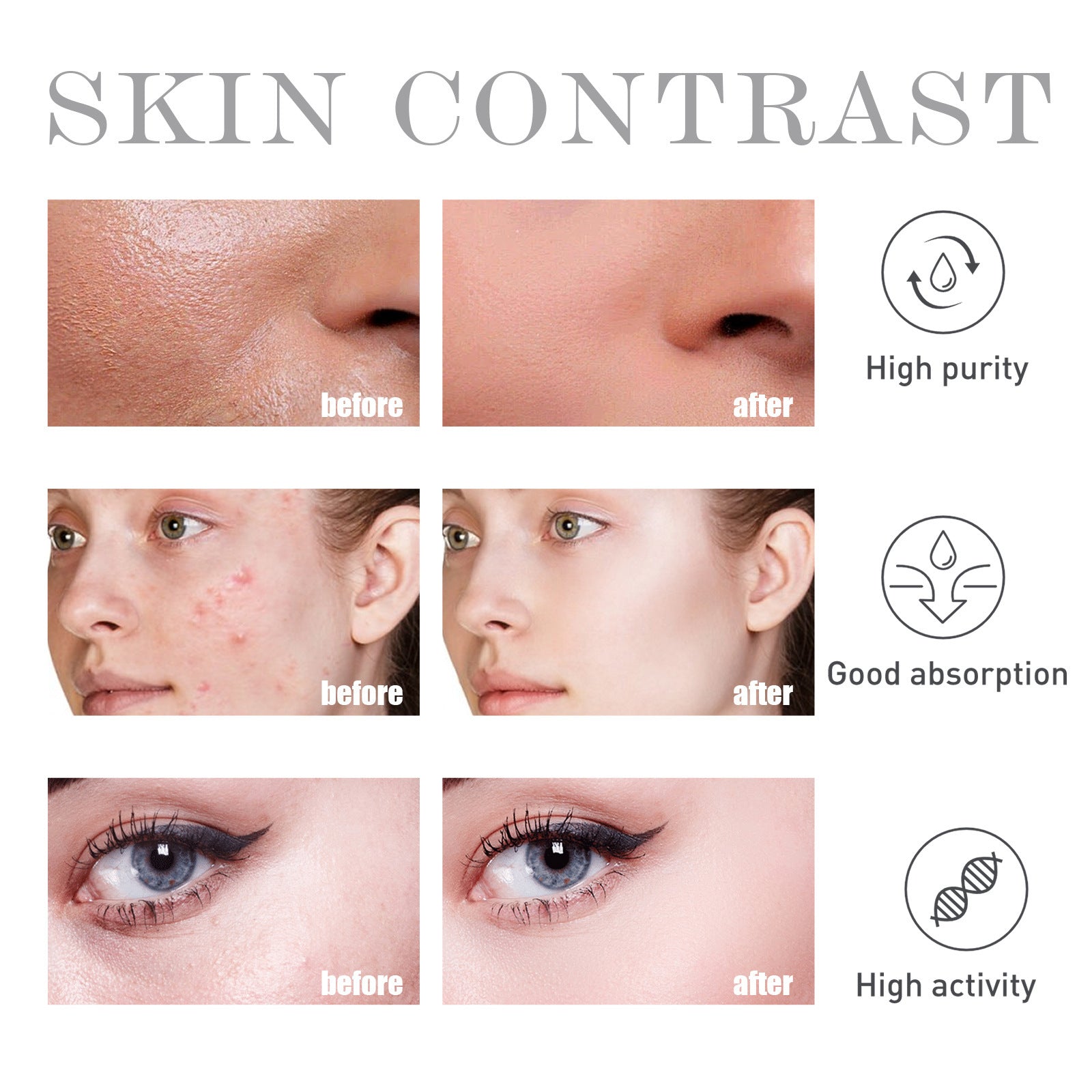 Salicylate Skin Repair Acne Skin Care Water chicpolly