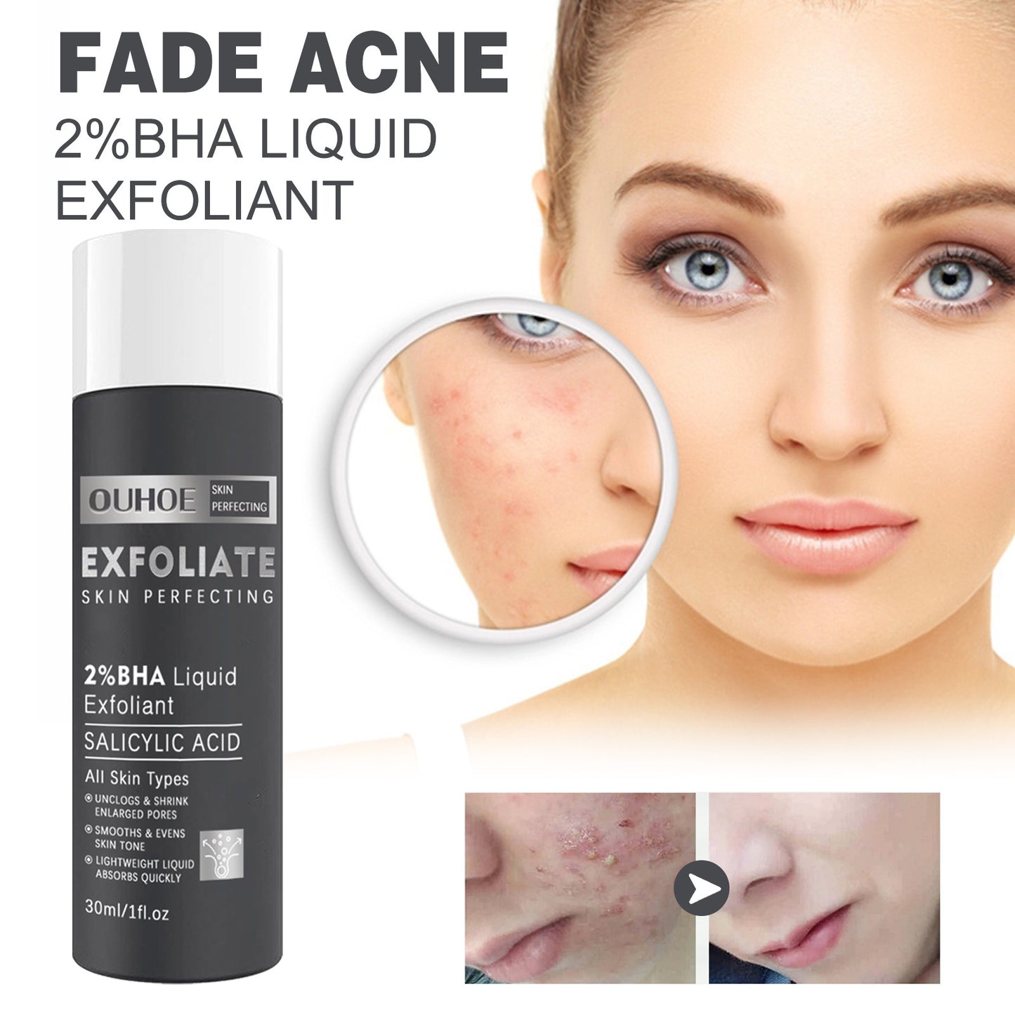 Salicylate Skin Repair Acne Skin Care Water chicpolly