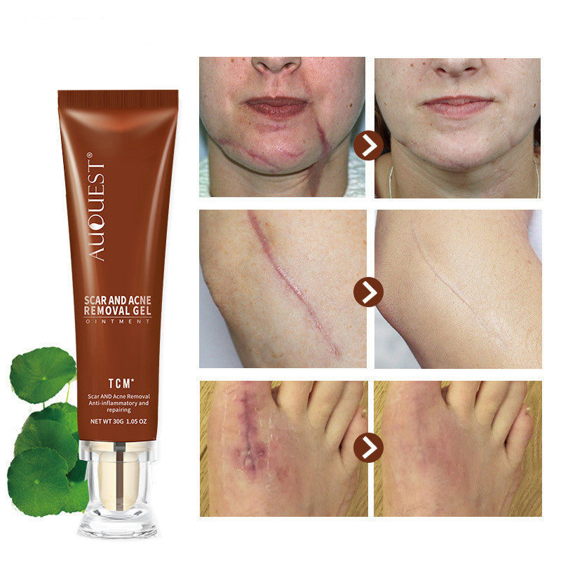 Moisturizing And Repairing Scar Skin Care Cream chicpolly