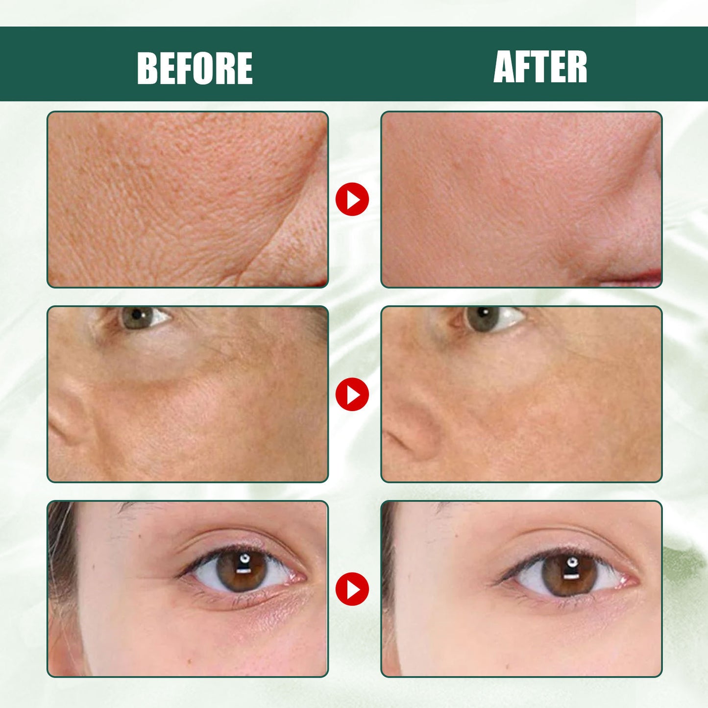 Intensive Anti-wrinkle Fade Fine Lines And Dark Circles Adjust Skin Tone Tighten And Moisturize Skin Care chicpolly